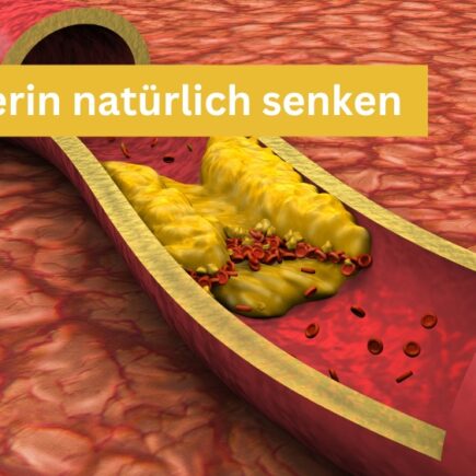 Cholesterin natürlich senken