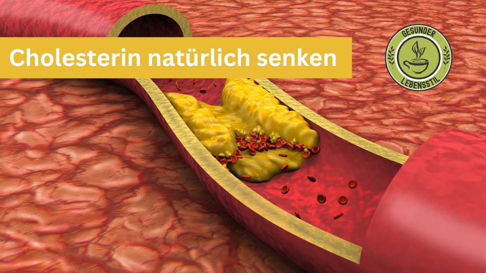 Cholesterin natürlich senken